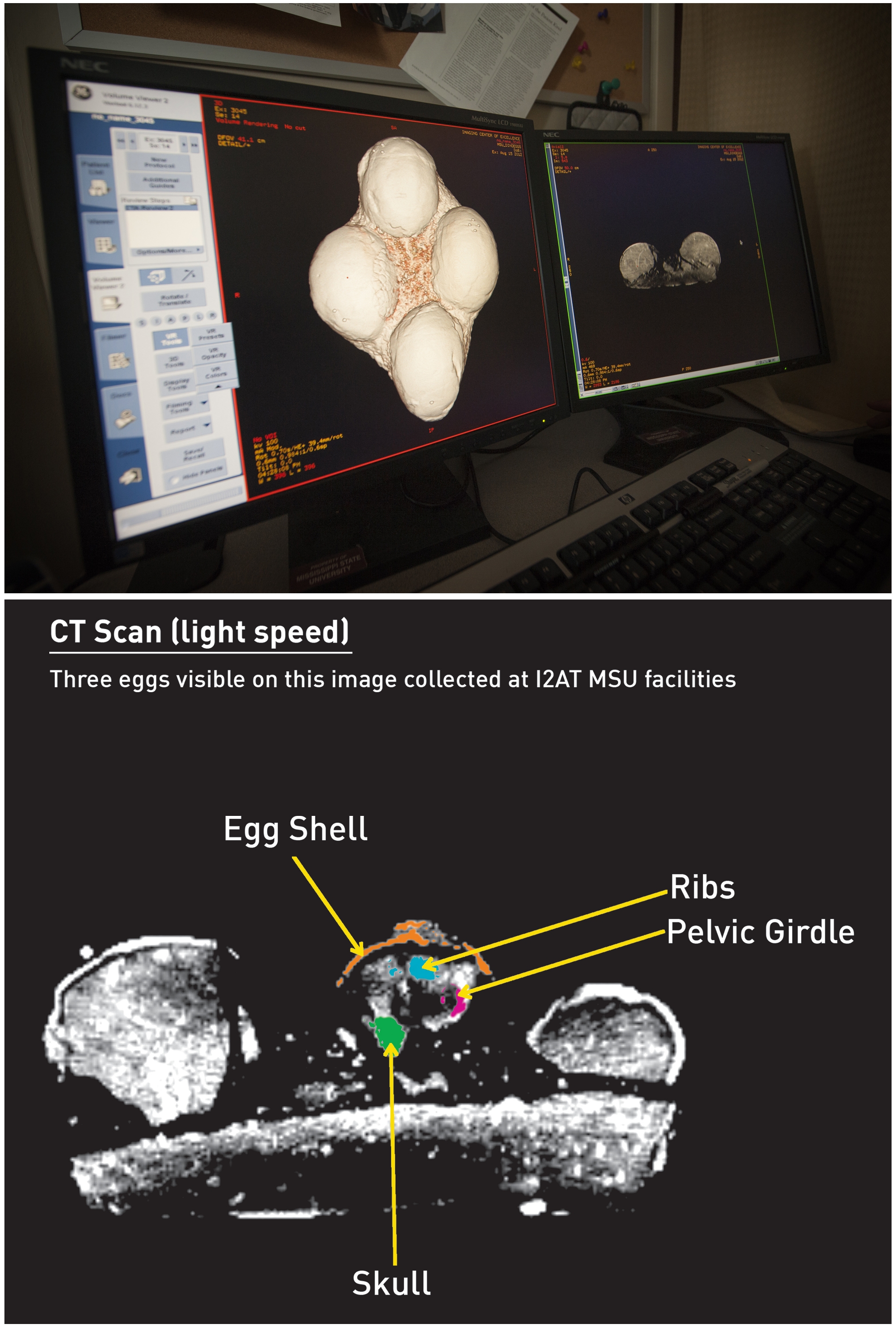 Top: Mississippi State's Institute for Imaging and Analytical Technologies, or I2AT, and Starkville-based Premier Imaging sponsored more than 10,000 X-rays of doctoral student John Paul Jones' dinosaur eggs in 2012. Bottom: At least one of the dinosaur eggs, highlighted, appears to be fully intact. In hopes of verifying genus and species, Jones has taken the eggs to Amgueddfa Cymru--National Museum Wales to learn more. Top: Mississippi State's Institute for Imaging and Analytical Technologies, or I2AT, and Starkville-based Premier Imaging sponsored more than 10,000 X-rays of doctoral student John Paul Jones' dinosaur eggs in 2012. Bottom: At least one of the dinosaur eggs, highlighted, appears to be fully intact. In hopes of verifying genus and species, Jones has taken the eggs to Amgueddfa Cymru--National Museum Wales to learn more.